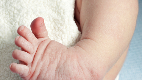 Thumbnail for Birth Defects Aren’t as Rare as You Think: 1 in 33 Babies is Born with One