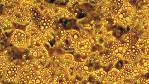 Thumbnail for Brown Fat Stem Cells – The Good Fat