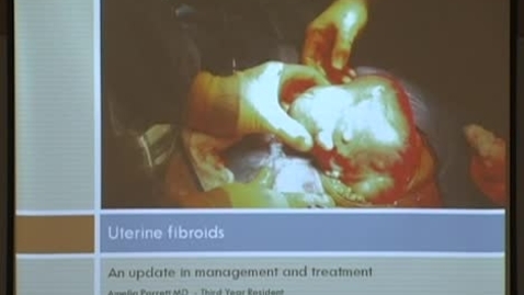 Thumbnail for An Update on the Management of Fibroids