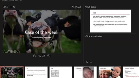 Thumbnail for 8/7/2020 To Biopsy or Not to Biopsy:  How dermoscopy and confocal microscopy can help, or not