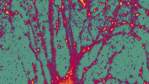 Thumbnail for New Insights Into the Complexities of Autism