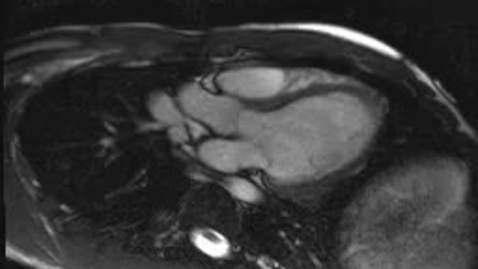 Thumbnail for Panel A Clip: Normal