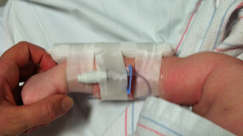 Thumbnail for Backed by Computer Power, Scientists Are Finding the Causes of Mysterious Diseases