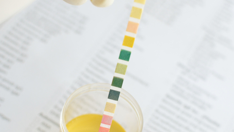 Thumbnail for Blood in the Urine - Should You Be Concerned?