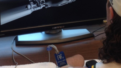 Thumbnail for A Prosthetic Hand that Moves &amp; Feels