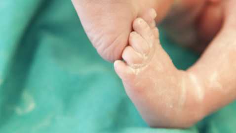 Thumbnail for When Should You Cut the Umbilical Cord?