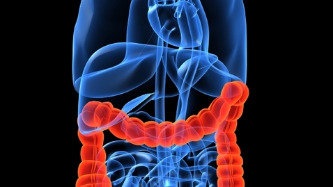Thumbnail for Screening Guidelines May Fail to Catch 10 Percent of Colon Cancers