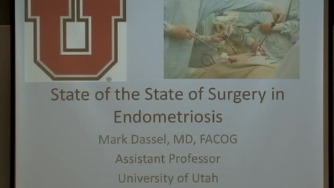 Thumbnail for 02/06/14 - Mark Dassel - State of the state of surgery in Endometriosis