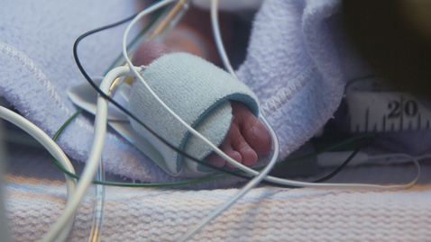 Thumbnail for Care for Very Premature Babies Improved, but Preterm Births Still Common