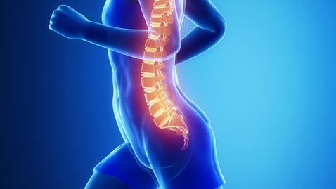 Thumbnail for Treating Severe Curving of the Spine