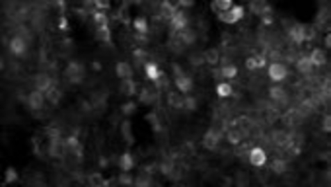 Thumbnail for Neurology-Brennan lab