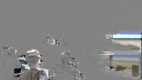 Thumbnail for 11/12/13 - Thyroid Disorders in the Elderly -- Dev Abraham MD