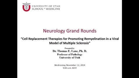 Thumbnail for Cell Replacement Therapies for Promoting Remyelination in a Viral Model of Multiple Sclerosis