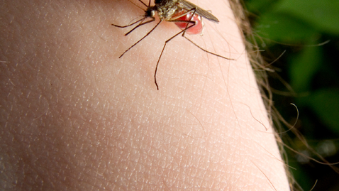 Thumbnail for Am I Normal: I'm a Mosquito Magnet