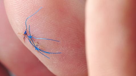 Thumbnail for ER or Not: Stitches