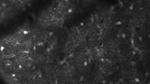 Thumbnail for Neurology-Brennan Lab