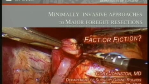 Thumbnail for Minimally Invasive Approaches to Major Foregut Resections: Fact or Fiction? - Cory Johnston, MD - 01/25/12