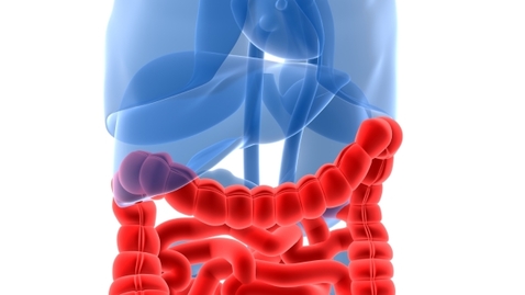 Thumbnail for entry How Accurate is a Colonoscopy?