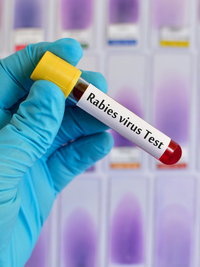 Could I Have Rabies? What to Look For and Steps to Take After an Animal Bite  | University of Utah Health