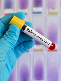 Could I Have Rabies? What to Look For and Steps to Take After an Animal