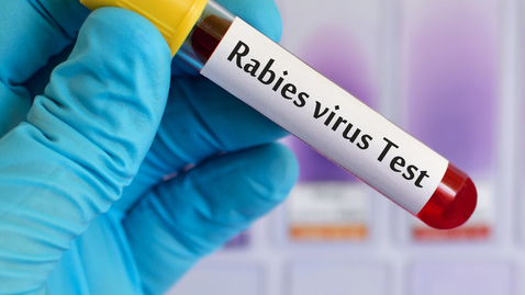 Thumbnail for Could I Have Rabies? What to Look For and Steps to Take After an Animal Bite