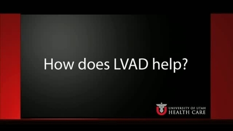 Thumbnail for How does LVAD help?