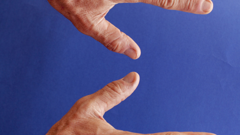 Thumbnail for Treating Dupuytrens Contracture