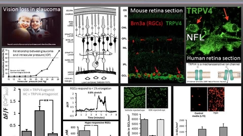 Thumbnail for Protecting the Retina From Pressure