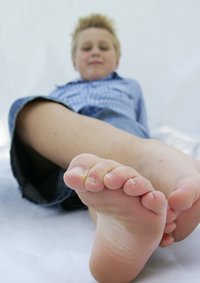 What to Do About Your Child's Ingrown Toenail | University of Utah Health