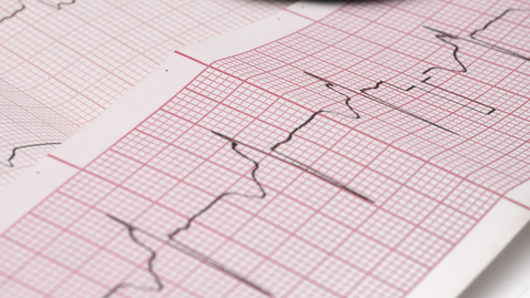 Thumbnail for Advances in Cardiology Imaging Mean Better Care
