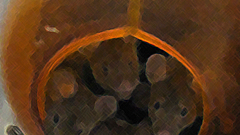 Thumbnail for An Enriched Lifestyle Slows Cancer in Mice