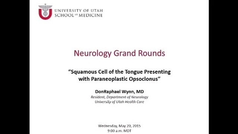 Thumbnail for Squamous Cell of the Tonge Presenting With Paraneoplastic Opsoclonus