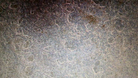 Thumbnail for IPSC Lab beating cardiomyocytes