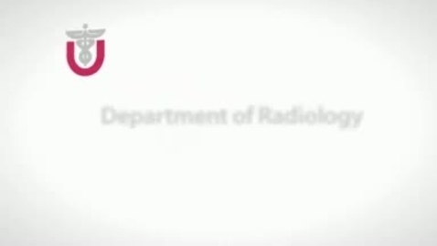 Thumbnail for Nuclear Medicine