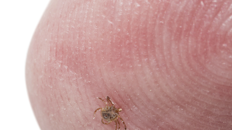 Thumbnail for Do I Need to Go to the ER to Remove a Tick?
