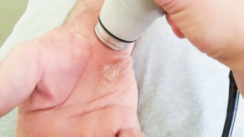Thumbnail for How Diagnostic Ultrasound Is Changing Orthopedics