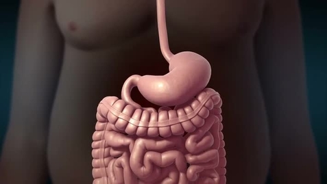 Thumbnail for entry Gastric Bypass