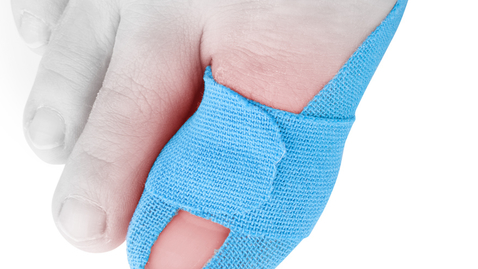 Thumbnail for Health Hack: How to Treat a Broken Toe at Home