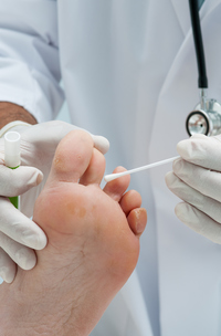 6 Natural Ways to Defeat Toenail Fungus - Runner's World