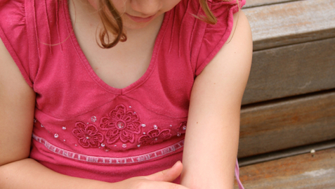 Thumbnail for Tips for Relieving your Child’s Eczema so They Stop Scratching