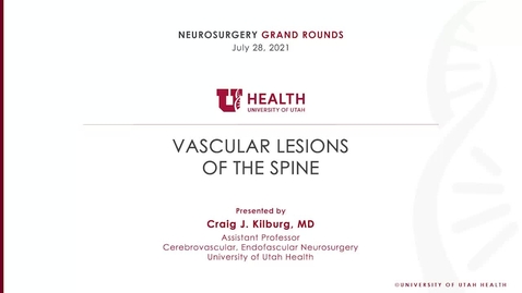 Thumbnail for Spinal Vascular Malformations