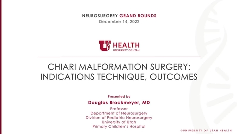 Thumbnail for Chiari Malformation Surgery: Indications Technique, Outcomes