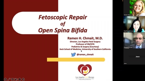 Thumbnail for Fetoscopic repair of open spina bifida
