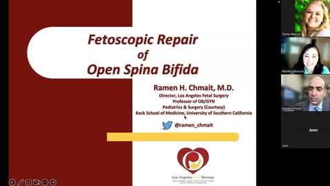 Thumbnail for entry Fetoscopic repair of open spina bifida