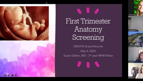 Thumbnail for entry First trimester anatomy screening