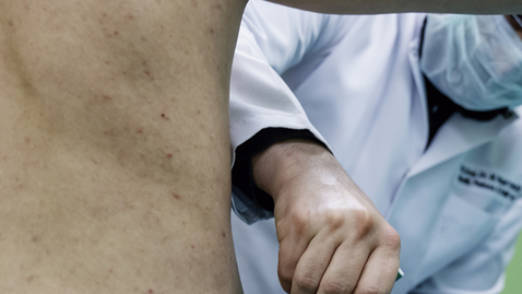 Thumbnail for What Type of Tummy Tuck or Abdominoplasty is Right for You?