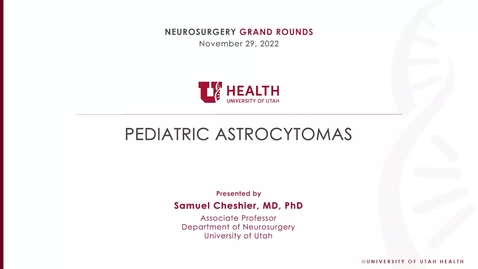 Thumbnail for Pediatric Astrocytomas