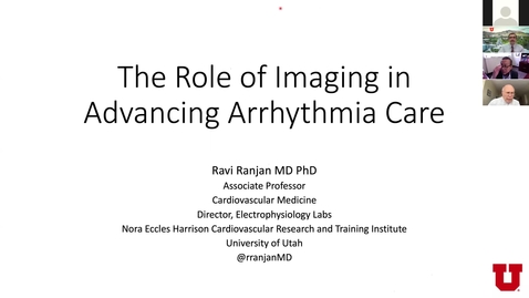 Thumbnail for The role of imaging in advancing arrhythmia care