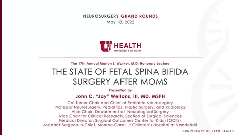 Thumbnail for The 17th Annual Marion L. Walker,   Honorary Lecture: The State of Fetal Spina Bifida Surgery after MOMS