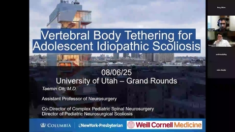 Thumbnail for Vertebral Body Tethering for Adolescent Idophathic Scoliosis
